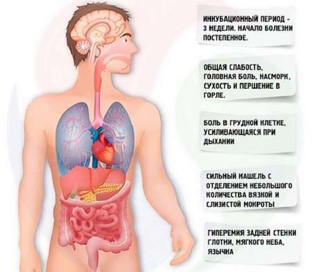 Правобічна пневмонія: симптоми і лікування