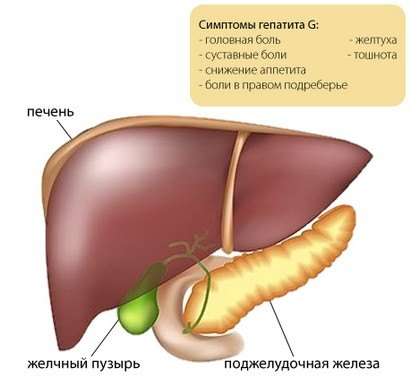 Гострий вірусний гепатит: симптоми і лікування