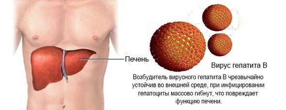 Вірусний гепатит: симптоми і лікування