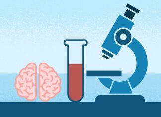 Аналіз крові Elecsys на хворобу Альцгеймера отримав дозвіл FDA