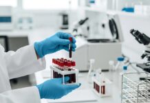 Розуміння васкулітів, пов’язаних з ANCA: GPA, MPA та EGPA