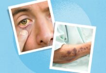 Безмолвный орган: как распознать проблемы и защитить здоровье печени