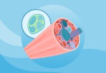 Розуміння хвороби Помпе: причини, типи та сучасні методи лікування