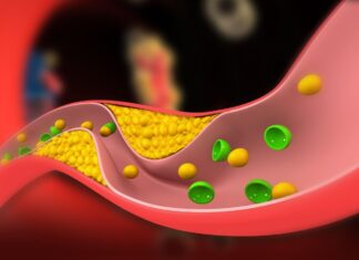 Утверждение FDA препарата Липфендра: что вам нужно знать о первой таблетке для снижения холестерина