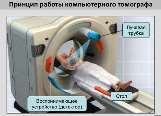 Ліподистрофія: симптоми і лікування