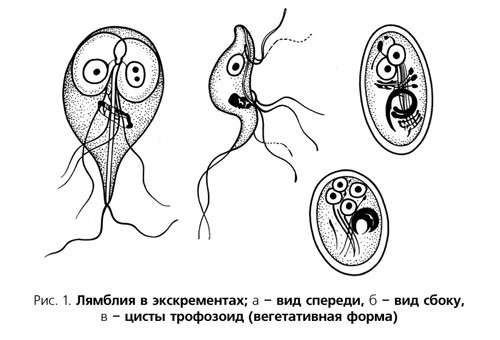 Лямбліоз у дітей: симптоми і лікування