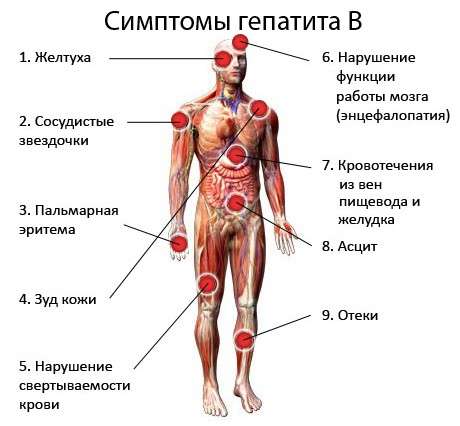 Гепатит В: симптоми і лікування