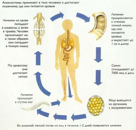 Анкілостомідоз: симптоми і лікування