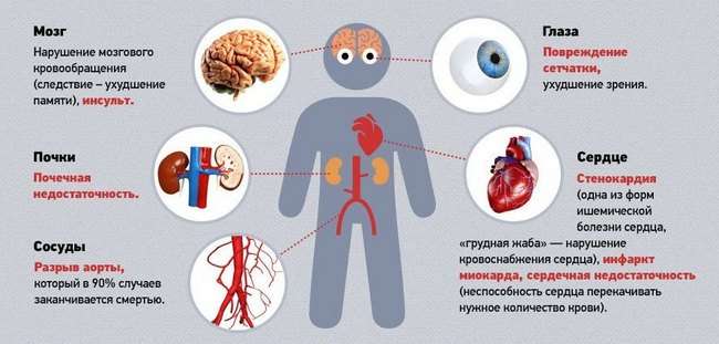 Гіпертонічна хвороба: симптоми і лікування