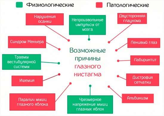 Ністагм: симптоми і лікування